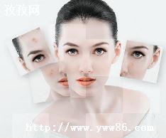 ô̶ӡ-ͼ3