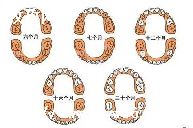 Ƿôʱ